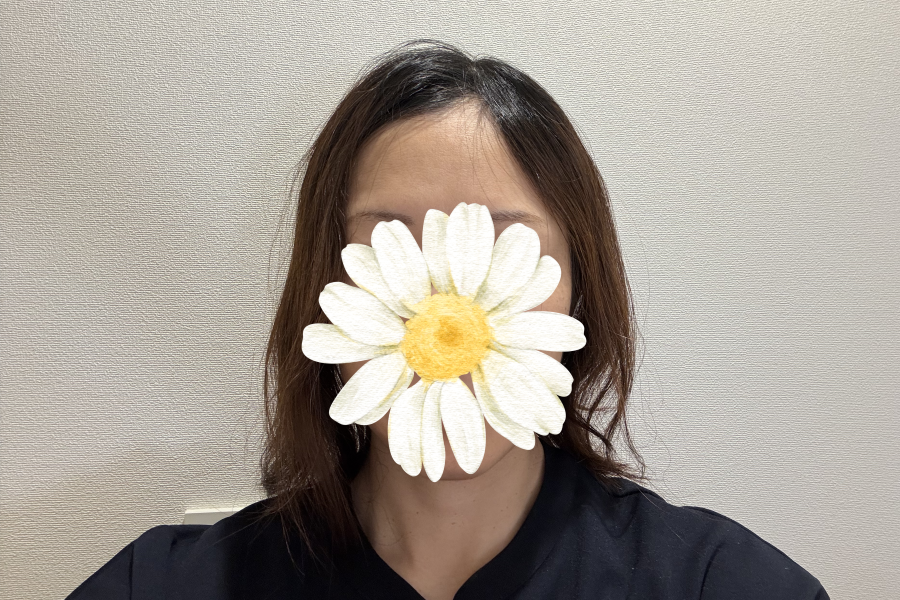 抗がん剤投与開始後６週間たった頭頂部のイメージ画像