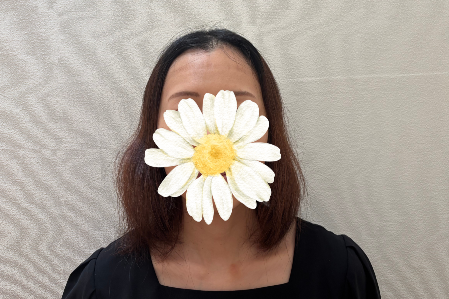 抗がん剤投与開始後7週間たった頭頂部のイメージ画像