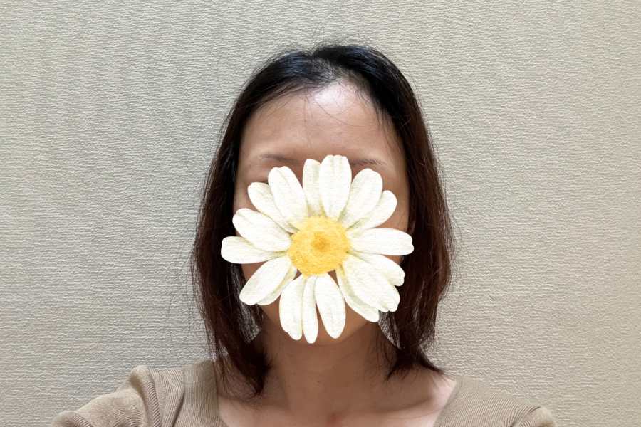 抗がん剤投与開始後９週間たった頭頂部のイメージ画像